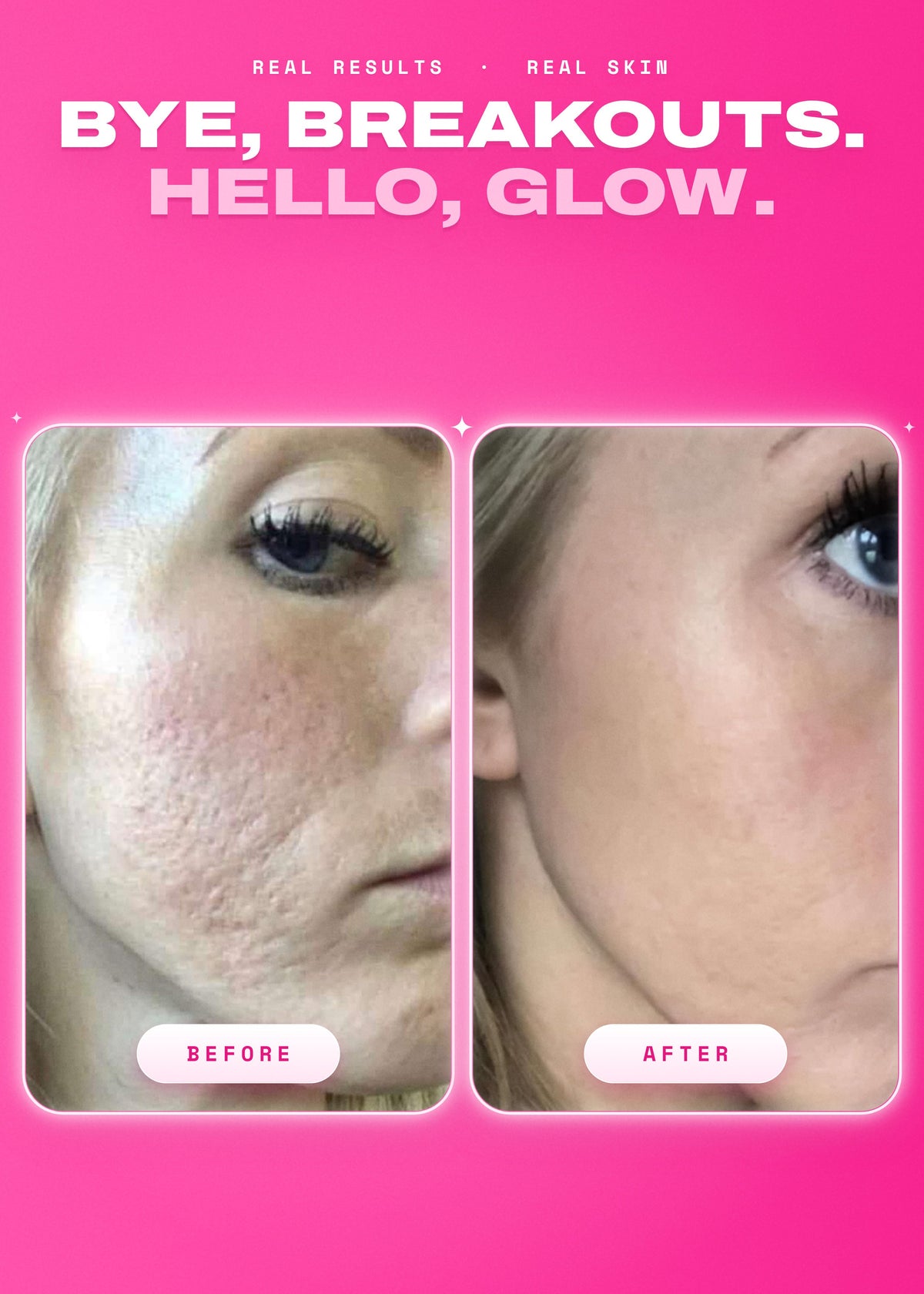 It Girl Skin | Strawberry Glow Beauty Gummies