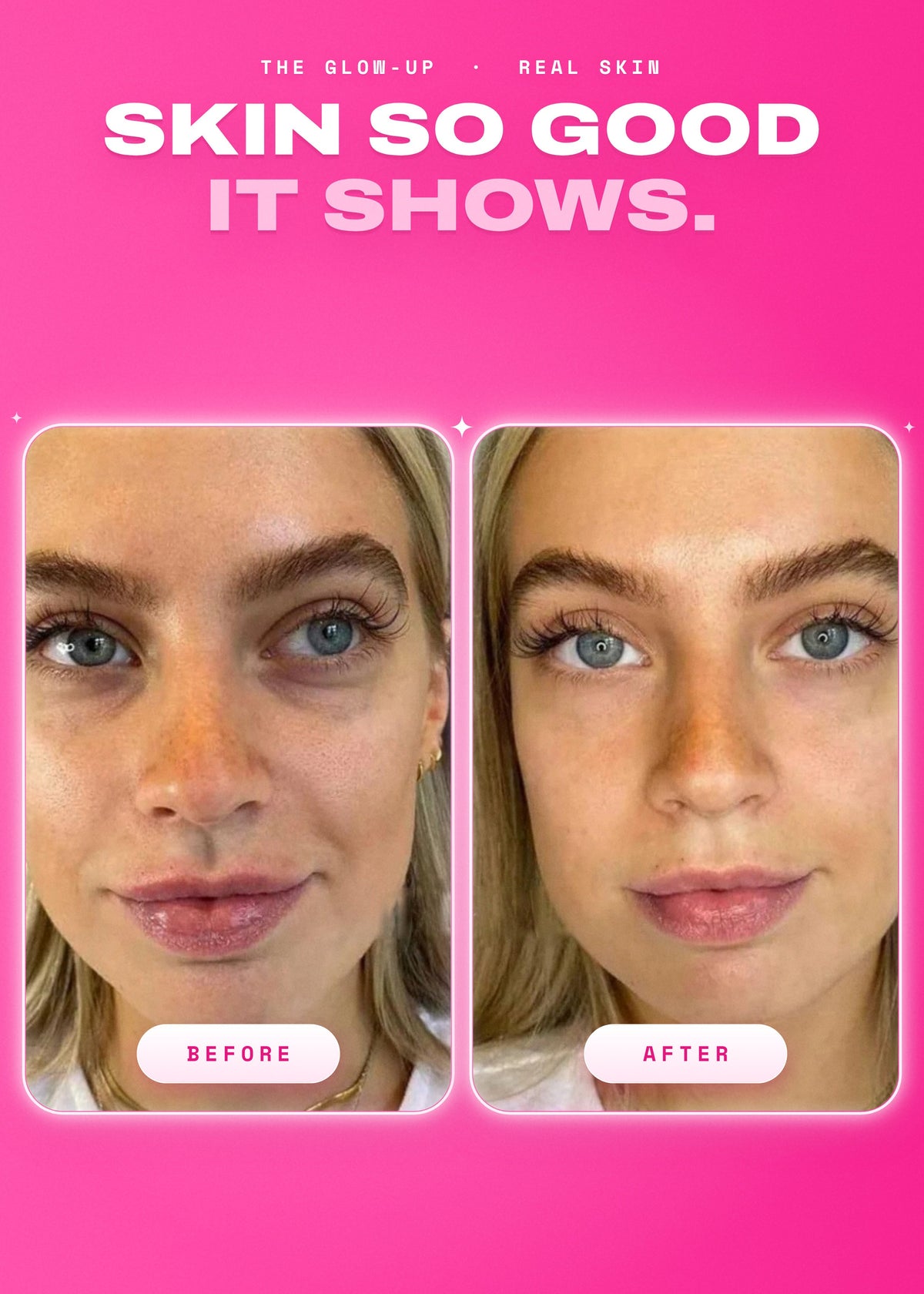 It Girl Skin | Strawberry Glow Beauty Gummies