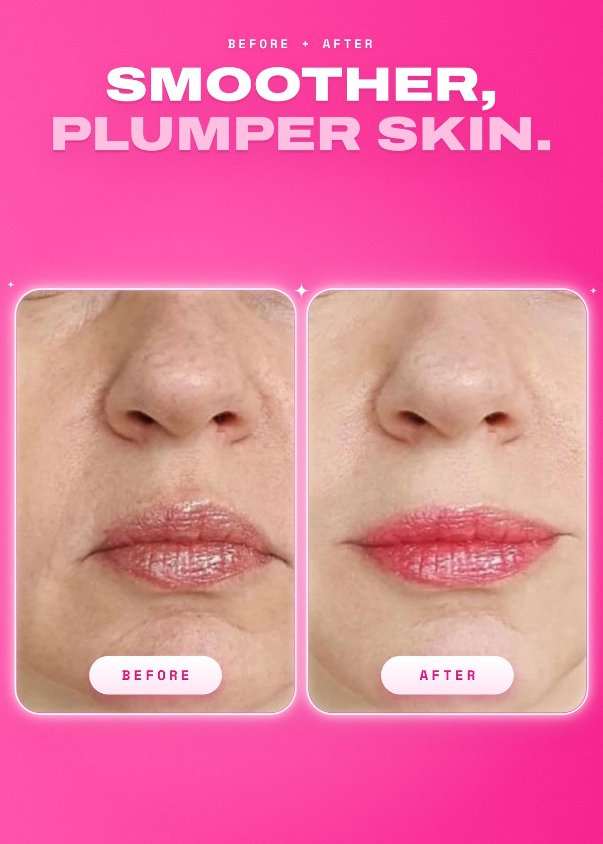 It Girl Skin | Strawberry Glow Beauty Gummies